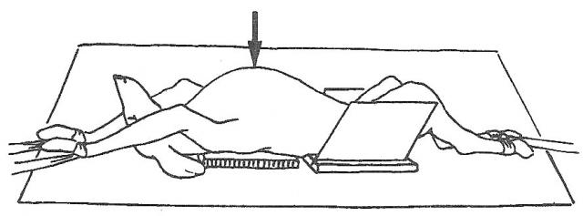 胸部腹背位投照摆位示意图