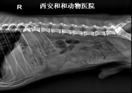 腹腔侧位片示例
