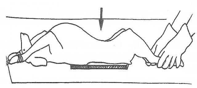 腹部腹背位X线投照示意图