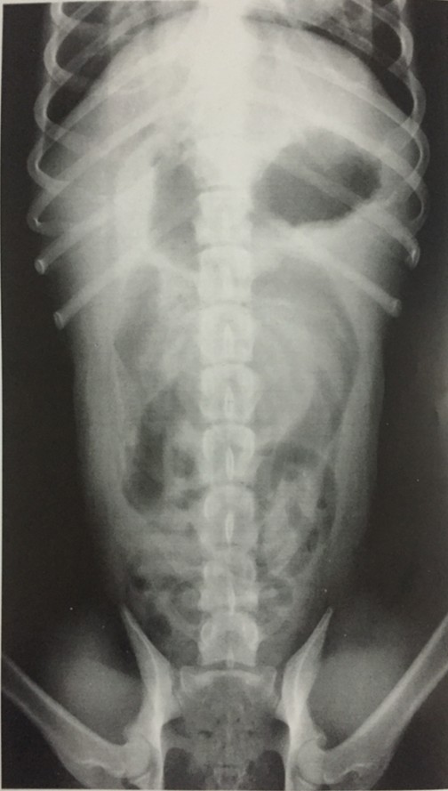 腹腔腹背位片示例