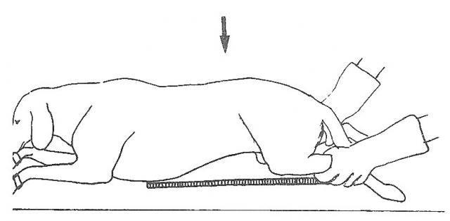 腹部背腹位X线投照示意图