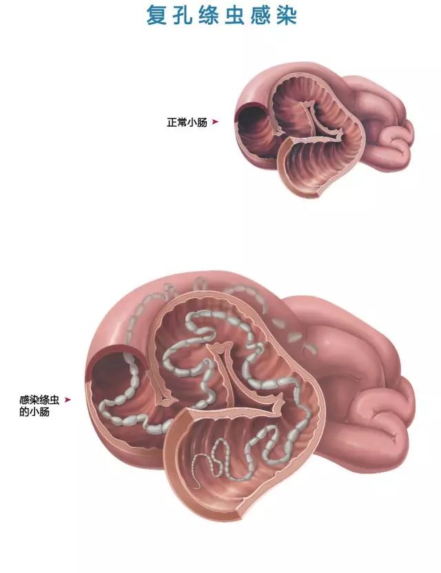 感染绦虫的小肠