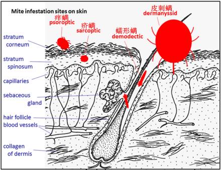 痒螨、疥螨、蠕形螨的寄生部位