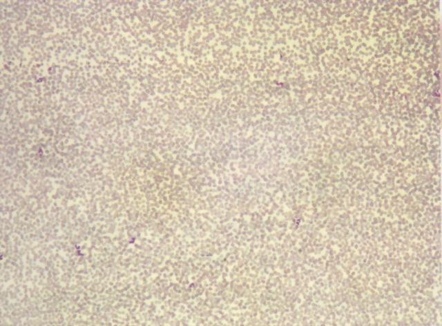 高倍镜下推制和染色良好的血涂片