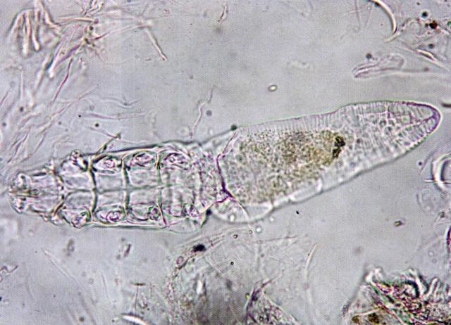 蠕形螨（犬，油法透明化，高倍）