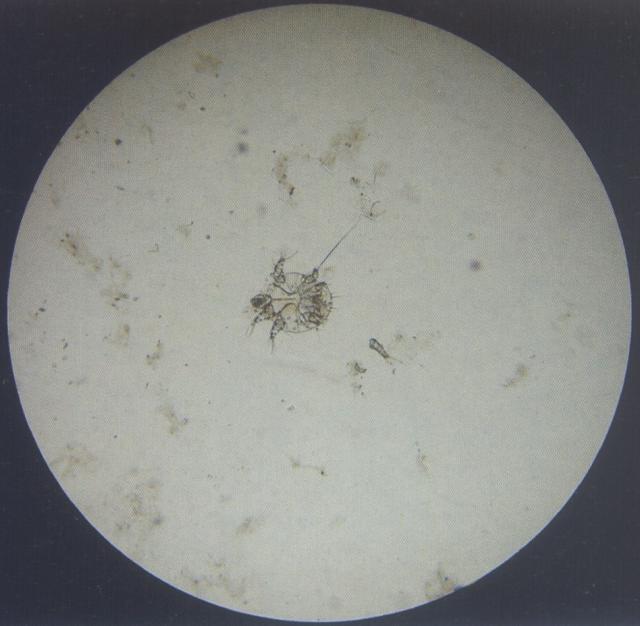 疥螨（犬，油法透明化）（100&times;）