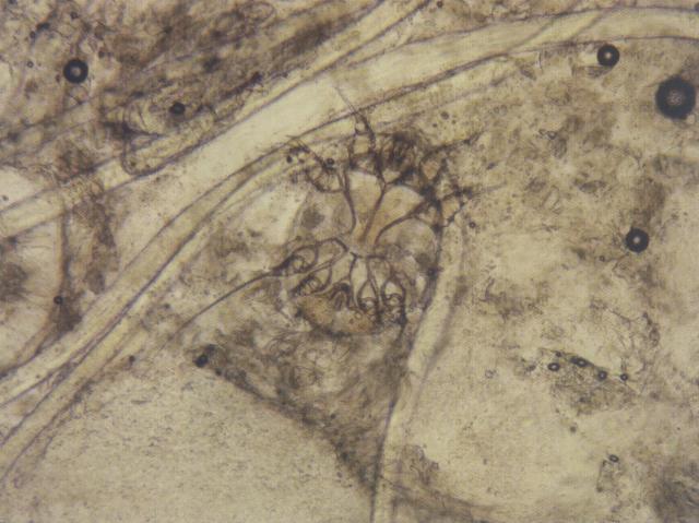 疥螨（犬，KOH法透明化）（100&times;5）