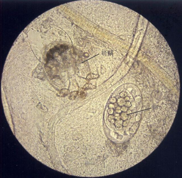 疥螨和疥螨的卵（犬，油法透明化，400&times;）