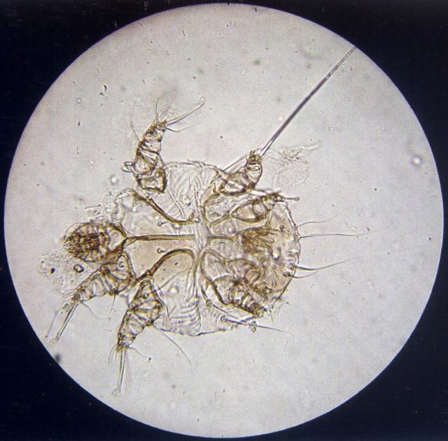 疥螨（犬，油法透明化，400&times;）