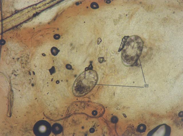 疥螨的卵（犬，油法透明化，400&times;）