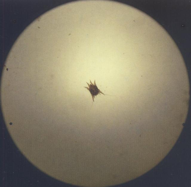 耳痒螨（猫，未透明化，40&times;）