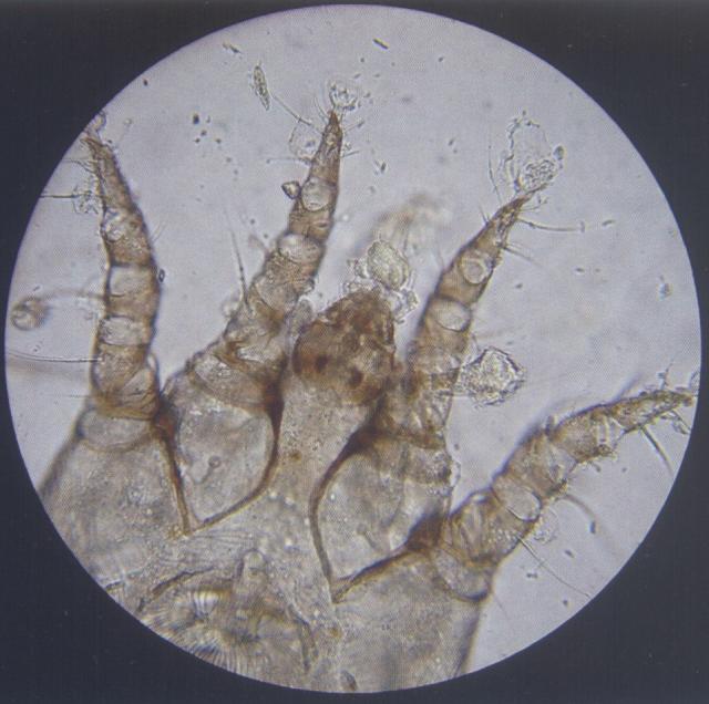 耳痒螨头部（猫，油法透明化，400&times;）