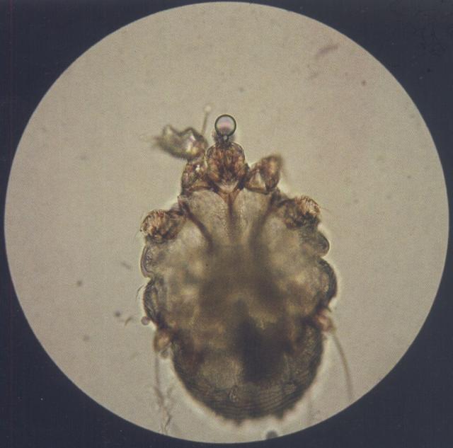 犬痒螨（油法透明化，400&times;）