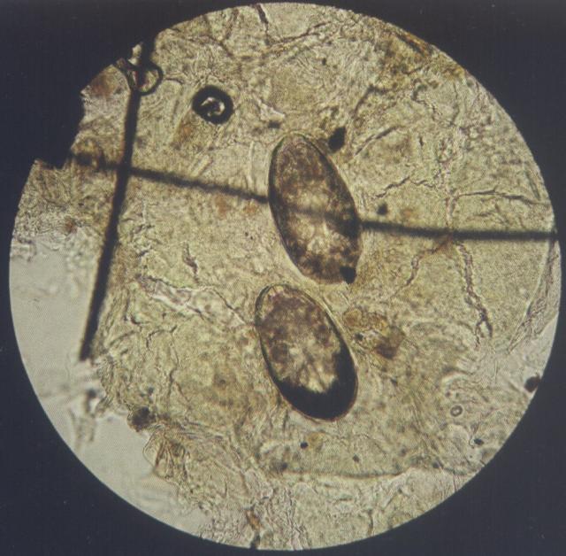 2个犬痒螨的卵（油法透明化，400&times;）